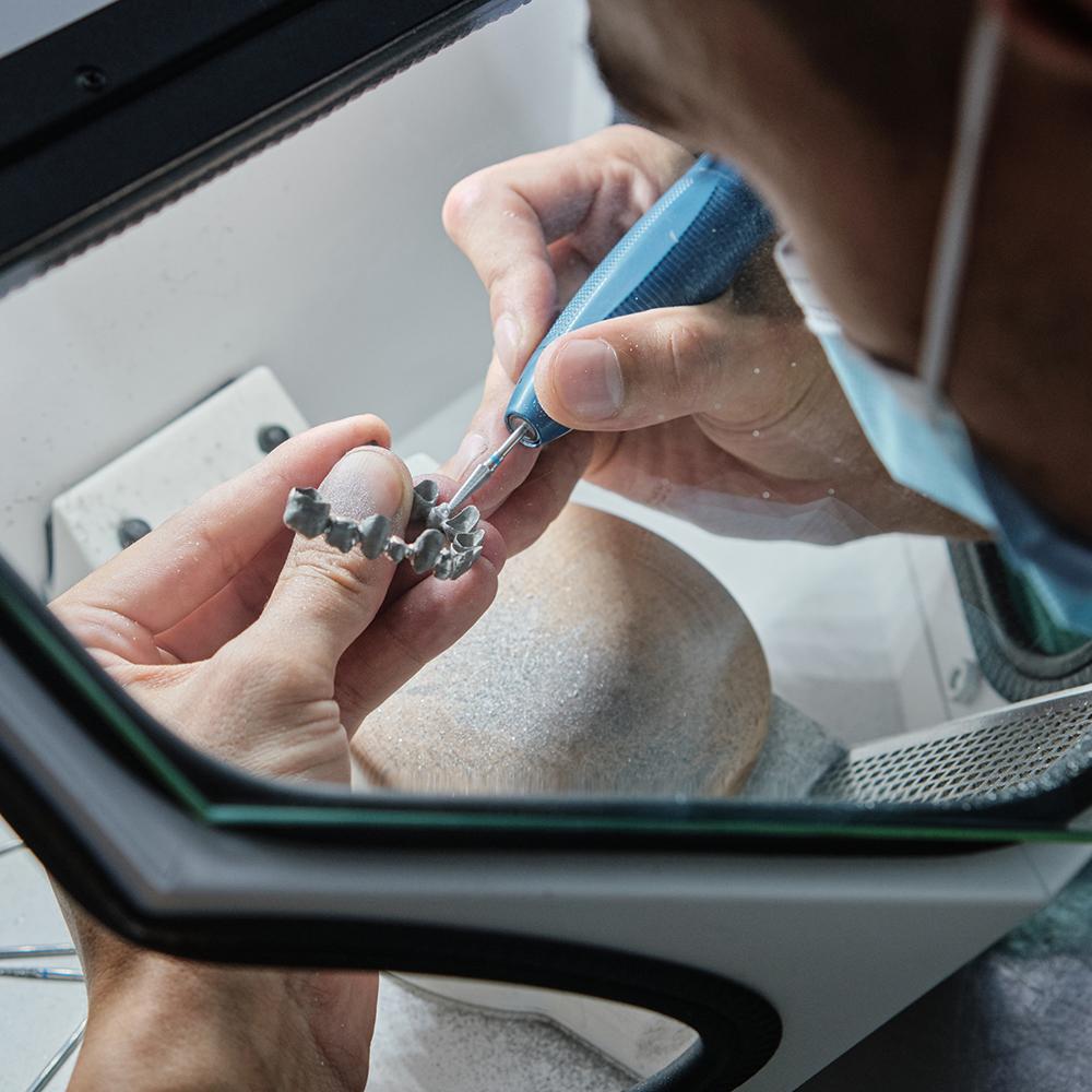 Recupero Metalli Preziosi da Scarti Dentali